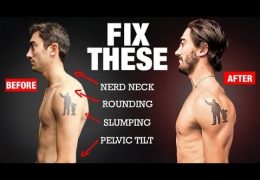 Fix Your Posture in 4 Moves! (PERMANENTLY)
